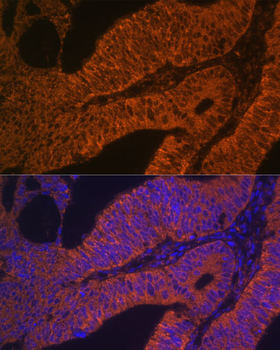 RAB5B antibody