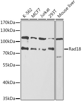 RAD18 antibody