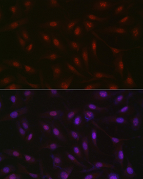 RBM14 antibody