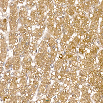 RCAN1 antibody