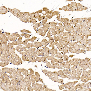 RCAN1 antibody