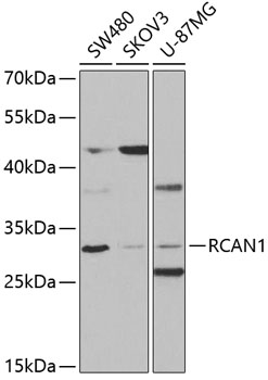 RCAN1 antibody