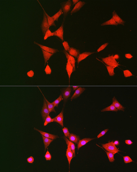 RPS6KB1 antibody