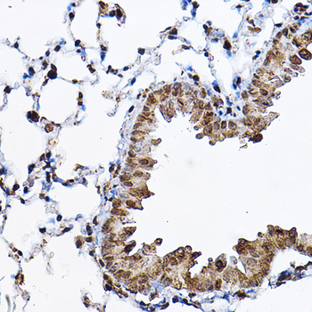 RPS6KB1 antibody