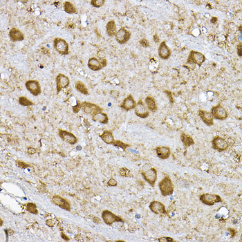 RPS6KB1 antibody