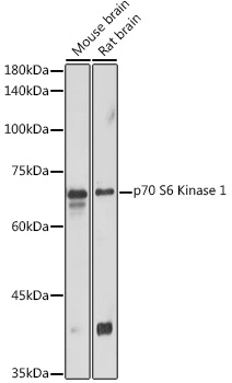 RPS6KB1 antibody