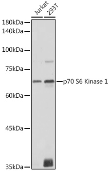 RPS6KB1 antibody