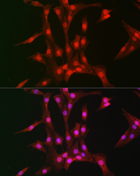 RPS6KB1 antibody