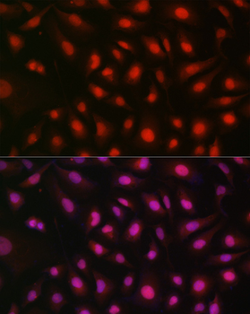 RPS6KB1 antibody