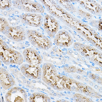 RPS6KB1 antibody