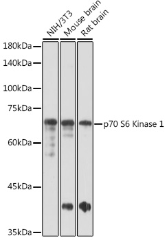 RPS6KB1 antibody