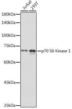 RPS6KB1 antibody