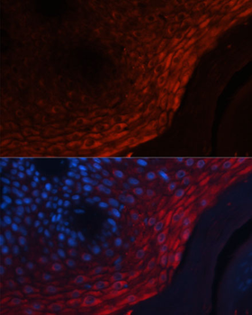 Calprotectin antibody