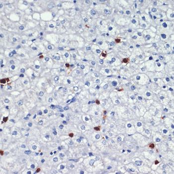 Calprotectin antibody