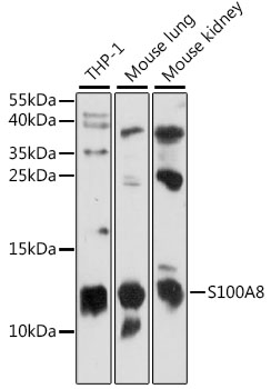 Calprotectin antibody