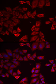 SEPHS1 antibody