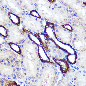 SIRT2 antibody