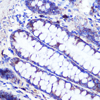 SIRT2 antibody