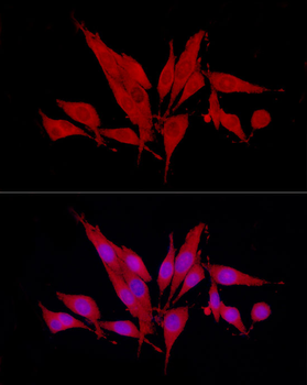 SIRT2 antibody