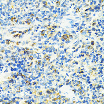 SLC25A11 antibody