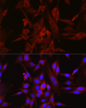 STAT6 antibody