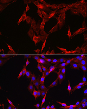 STAT6 antibody