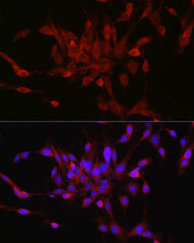 STAT6 antibody