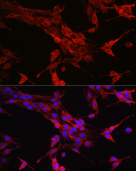 STAT6 antibody