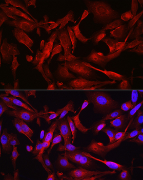 STAT6 antibody