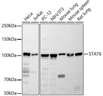 STAT6 antibody