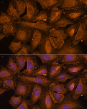 STUB1 antibody