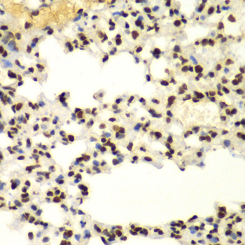 SUMO2 antibody