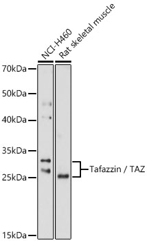 Tafazzin / TAZ antibody