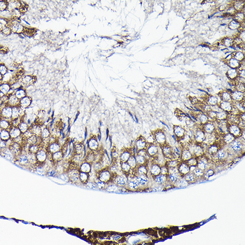 TCP1 antibody