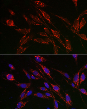 TFEB antibody