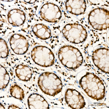 TFEB antibody