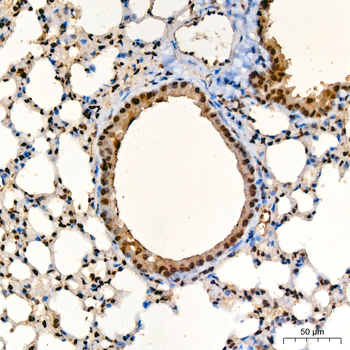 TFEB antibody