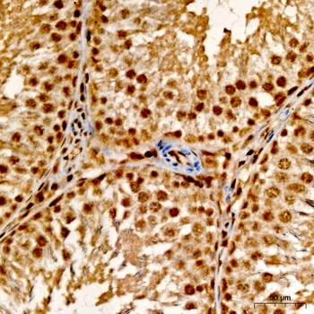 TFEB antibody