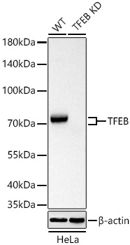 TFEB antibody