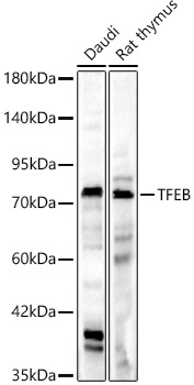 TFEB antibody