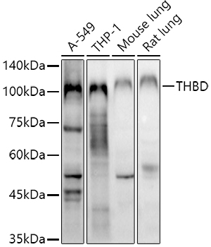 THBD antibody