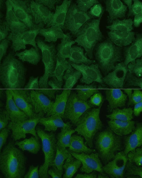 TIMM8B antibody