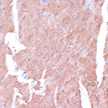 TIMM8B antibody