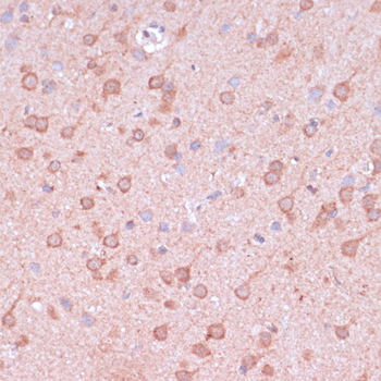 TIMM8B antibody