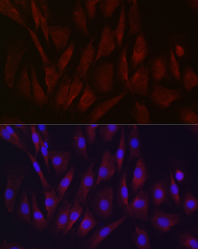 TIMP2 antibody