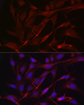 TIMP2 antibody