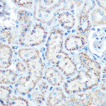 TIMP2 antibody