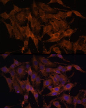 TLR3 antibody