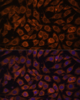 TLR3 antibody