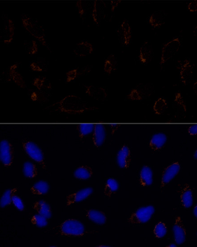 TRAP1 antibody